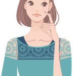 【50代】その吹き出物は顔ダニかも!【美肌アンテナ】