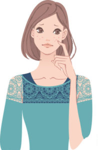 【50代】その吹き出物は顔ダニかも!【美肌アンテナ】